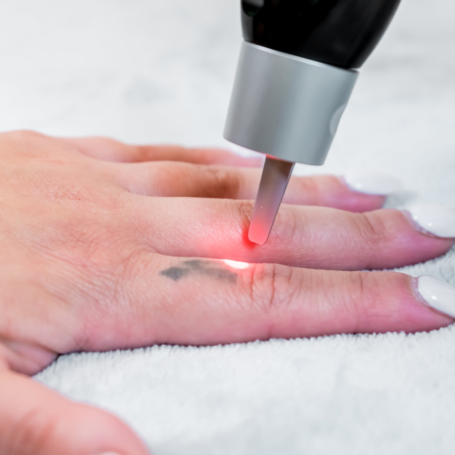 Bright red laser light zapping a small, faded tattoo on the side of a finger. 10 Laser Tattoo Removal Aftercare Best Practices Every Artist Should Know