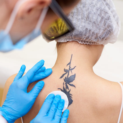Specialist prepping a dark floral back tattoo for a saline removal session.