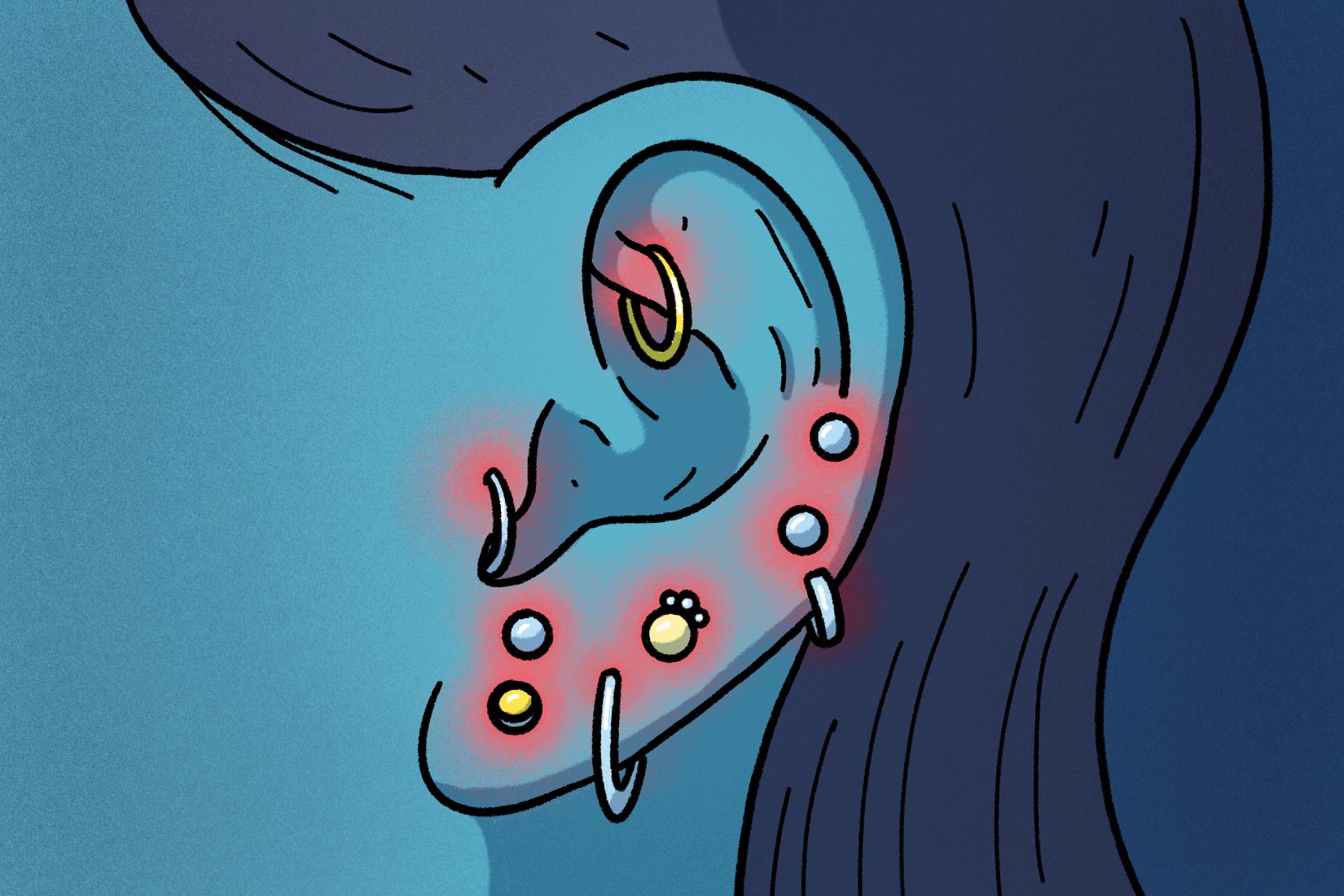 illustration of multiple ear piercings on an ear with glowing red orbs to indicate infection How to Treat an Infected Ear Piercing