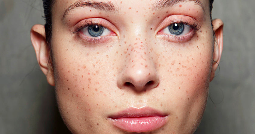 Freckle tattoo, make up tattoo, beauty tattoo Freckle Tattoos