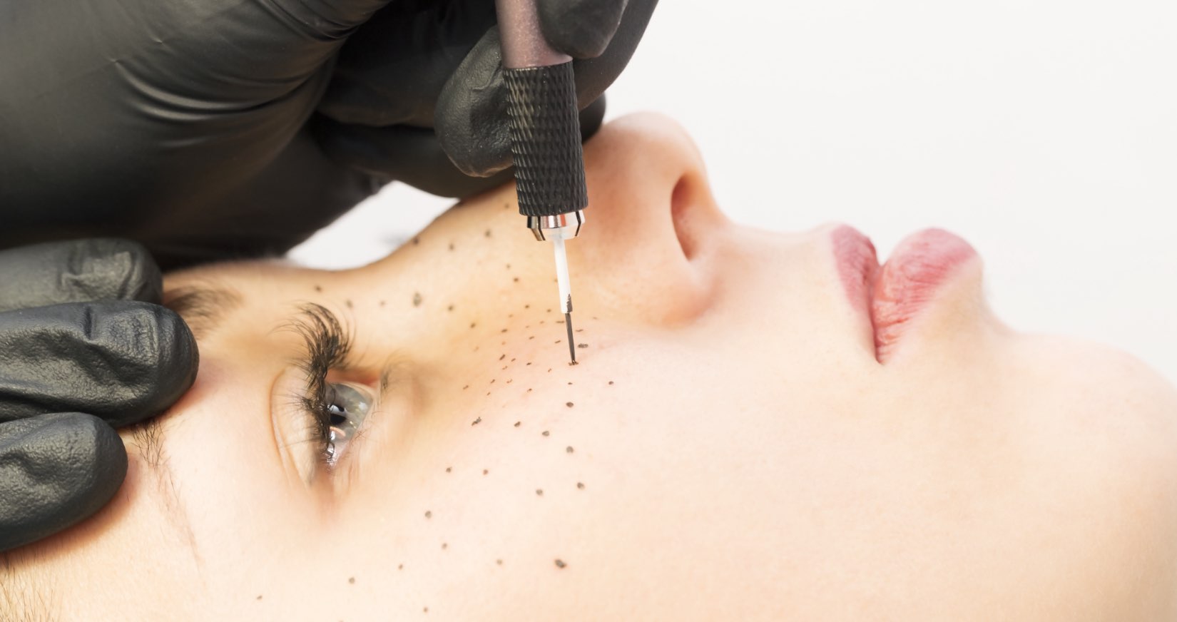 Woman getting faux freckle tattoos by stick and poke method Freckle Tattoos: The Ultimate Guide