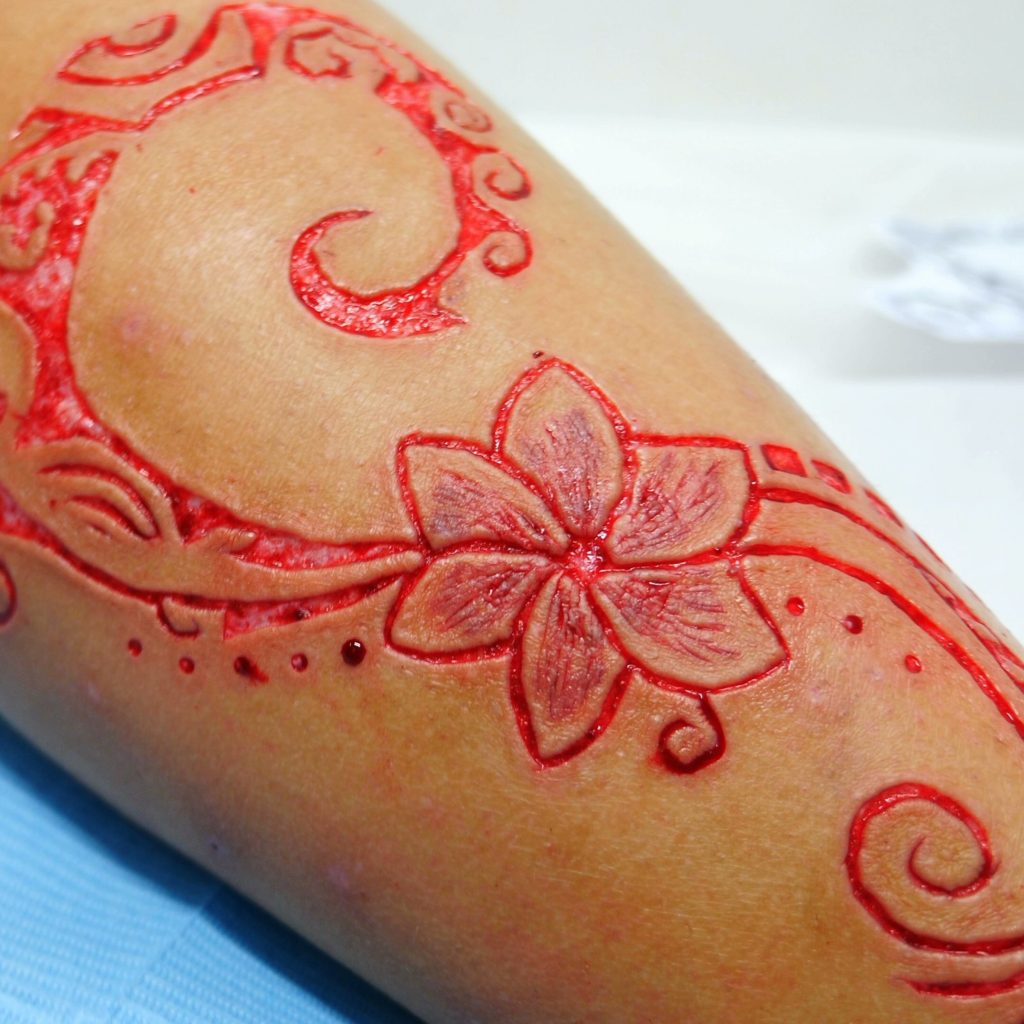 Scarification