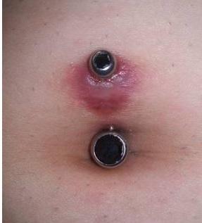Bad Belly Piercings