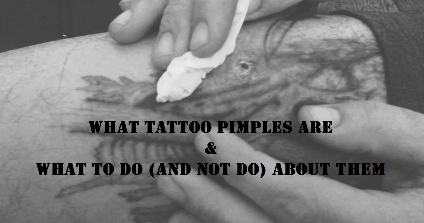 tattoo pimples, tattoo care, tattoo infection care Tattoo Pimples - How to Treat AND Avoid!