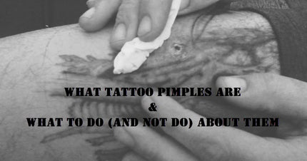 tattoo pimples, tattoo care, tattoo infection care