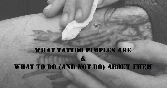 tattoo pimples, tattoo care, tattoo infection care