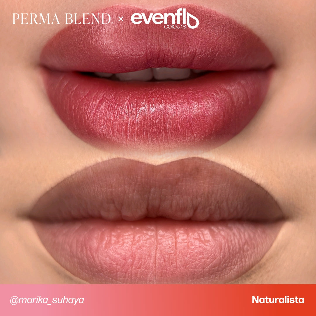 Evenflo True Lips Set — 6 1/2oz Bottles