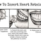 Kaos Heart Retainer Insertion Guide