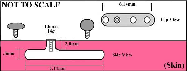 Suggested Size for Dermal Anchors to Use With Our Flathead Screw Ends for Internal Body Jewelry