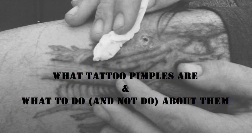 Dealing with PIMPLES, IRRITATION, RASHES & INFECTION on a NEW TATTOO -  YouTube