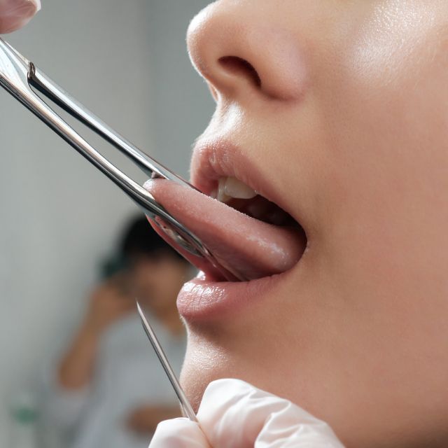 Client getting a tongue piercing