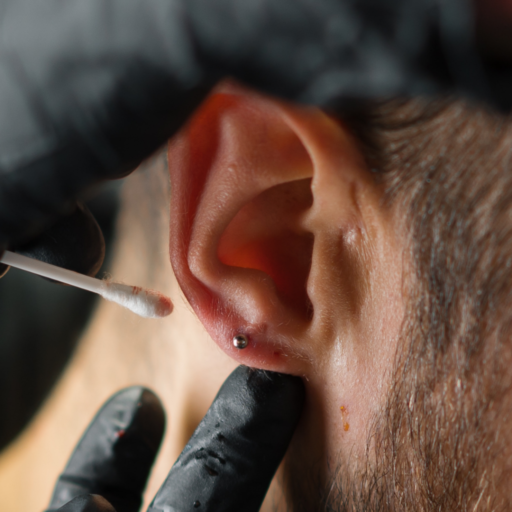 Treatment of an ear piercing with a cotton swab.